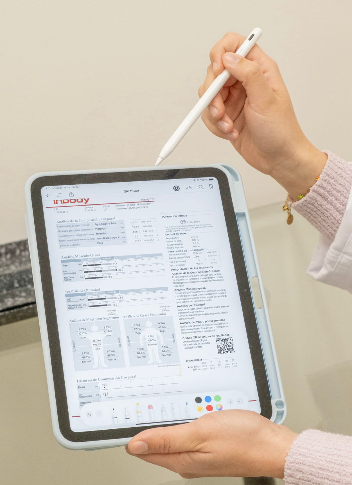 Informe InBody de composición corporal en Clínica Acerete